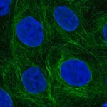 Merck Anti-SH2D3A antibody produced in rabbit