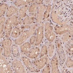 Merck Anti-MAPKAPK2 antibody produced in rabbit