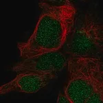 Merck Anti-LYSMD1 antibody produced in rabbit