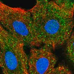 Merck Anti-AKT2 antibody produced in rabbit