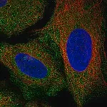 Merck Anti-AKR7A2 antibody produced in rabbit