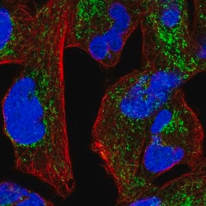 Merck Anti-NDUFS1 antibody produced in rabbit