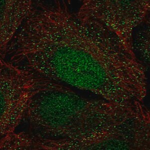Merck Anti-HOXA2 antibody produced in rabbit