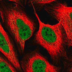 Merck Anti-MED6 antibody produced in rabbit