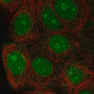 Merck Anti-TSSC1 antibody produced in rabbit