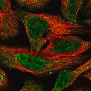 Merck Anti-BTRC antibody produced in rabbit