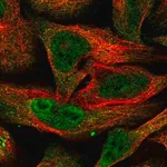 Merck Anti-BTRC antibody produced in rabbit