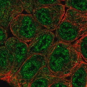 Merck Anti-EPAS1 antibody produced in rabbit