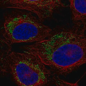 Merck Anti-CCR7 antibody produced in rabbit