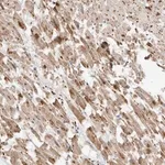 Merck Anti-MTUS2 antibody produced in rabbit