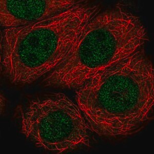 Merck Anti-VHL antibody produced in rabbit