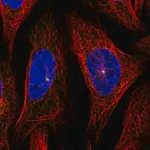 Merck Anti-AHI1 antibody produced in rabbit