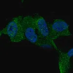 Merck Anti-TTBK1 antibody produced in rabbit