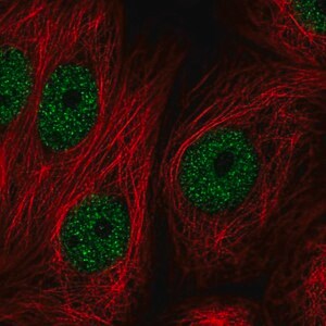 Merck Anti-ZBTB21 antibody produced in rabbit