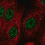 Merck Anti-ZBTB21 antibody produced in rabbit