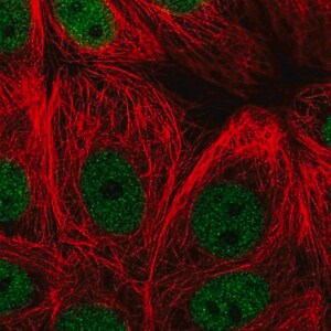 Merck Anti-ZBTB21 antibody produced in rabbit