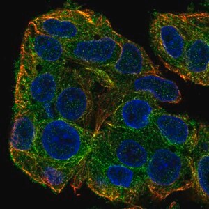 Merck Anti-SLC38A3 antibody produced in rabbit
