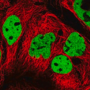 Merck Anti-PPP1R14A antibody produced in rabbit