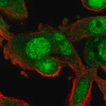 Merck Anti-RGS12 antibody produced in rabbit