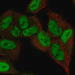 Merck Anti-ZNF333 antibody produced in rabbit