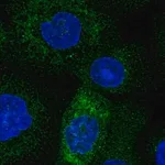 Merck Anti-TMCO1 antibody produced in rabbit
