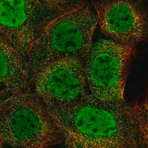 Merck Anti-ZMYM4 antibody produced in rabbit