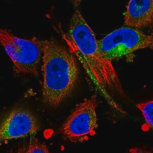 Merck Anti-MARCKS antibody produced in rabbit