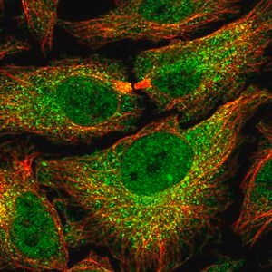 Merck Anti-PSMB7 antibody produced in rabbit