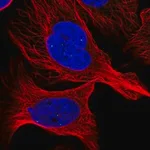 Merck Anti-ATMIN antibody produced in rabbit