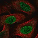 Merck Anti-HOXC6 antibody produced in rabbit