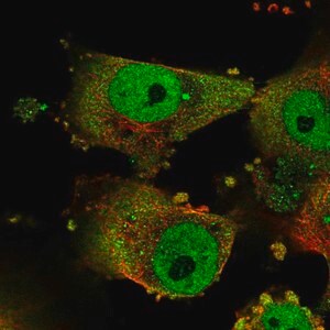 Merck Anti-GPATCH3 antibody produced in rabbit