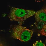 Merck Anti-GPATCH3 antibody produced in rabbit