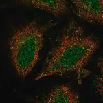 Merck Anti-CCDC122 antibody produced in rabbit