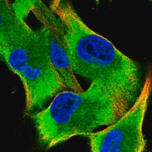 Merck Anti-SARS antibody produced in rabbit