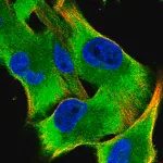 Merck Anti-SARS antibody produced in rabbit