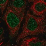Merck Anti-TMEM8A antibody produced in rabbit