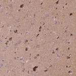 Merck Anti-SNCAIP antibody produced in rabbit