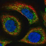 Merck Anti-SLC44A1 antibody produced in rabbit