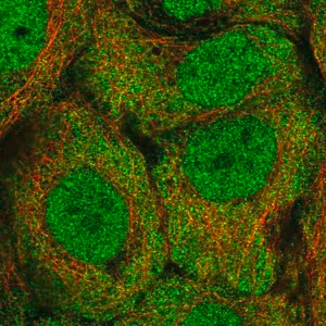Merck Anti-ALDH1A3 antibody produced in rabbit