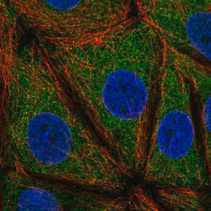 Merck Anti-VMP1 antibody produced in rabbit