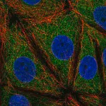 Merck Anti-VMP1 antibody produced in rabbit