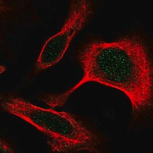 Merck Anti-DAPK3 antibody produced in rabbit