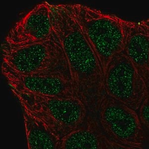 Merck Anti-ABCA6 antibody produced in rabbit