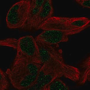 Merck Anti-PGBD5 antibody produced in rabbit