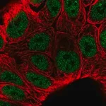 Merck Anti-KLF3 antibody produced in rabbit