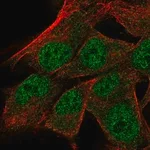 Merck Anti-TRNAU1AP antibody produced in rabbit
