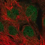 Merck Anti-MGMT antibody produced in rabbit