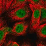 Merck Anti-MGMT antibody produced in rabbit