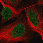 Merck Anti-ASXL2 antibody produced in rabbit
