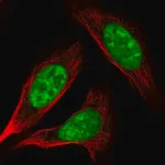 Merck Anti-AK6 antibody produced in rabbit